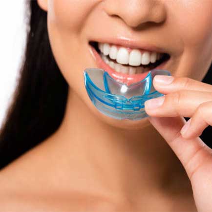 Athletic Mouthguards