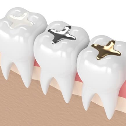 Fillings