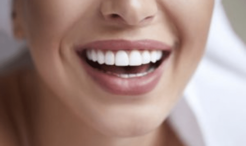 Cosmetic-Dentistry-21