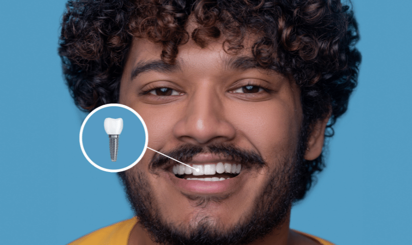 Dental Crowns
