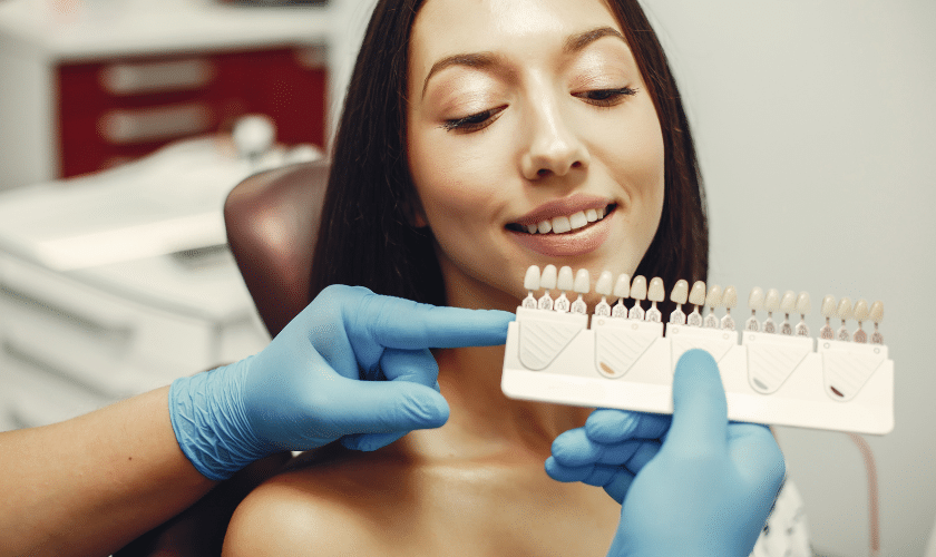 veneers