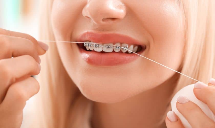 Orthodontics Treatment in East Downtown Houston