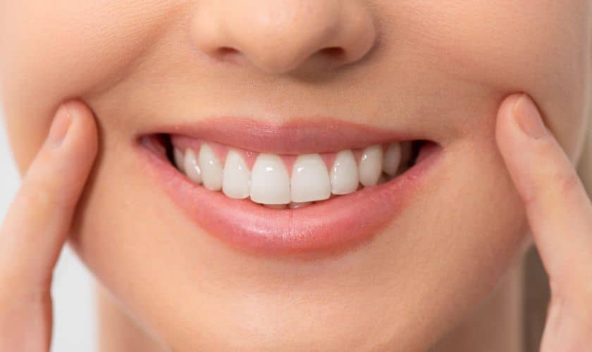 teeth whitening in houston