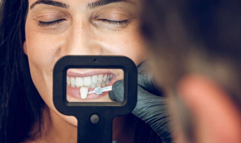 veneers in East Downtown Houston