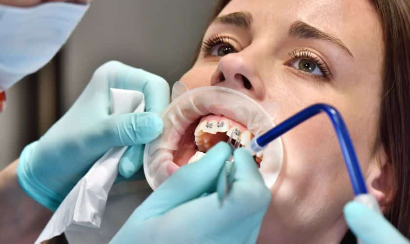 Orthodontic treatment in East Downtown
