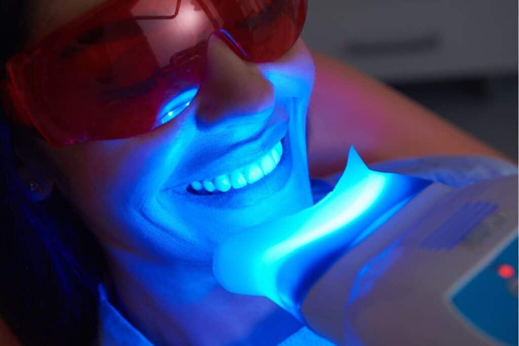 Teeth Whitening in Houston, TX