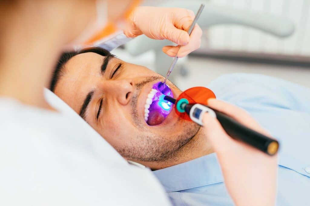 Cosmetic Bonding in Houston TX