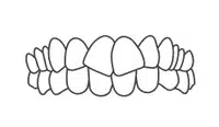 Illustration of front-facing upper and lower teeth in proper alignment and occlusion.