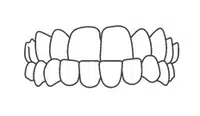Dental braces or orthodontic appliance showing upper and lower teeth alignment wireframe diagram.