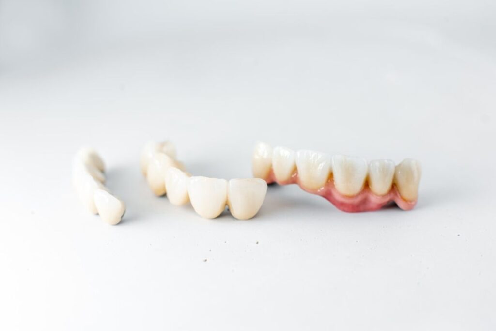 Dental crown in East Downtown