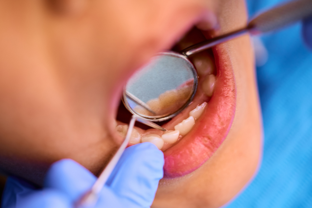 delta dental dentist in houston