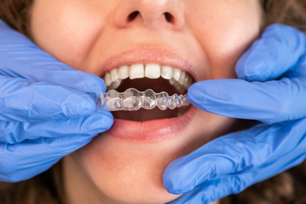 orthodontist in Houston