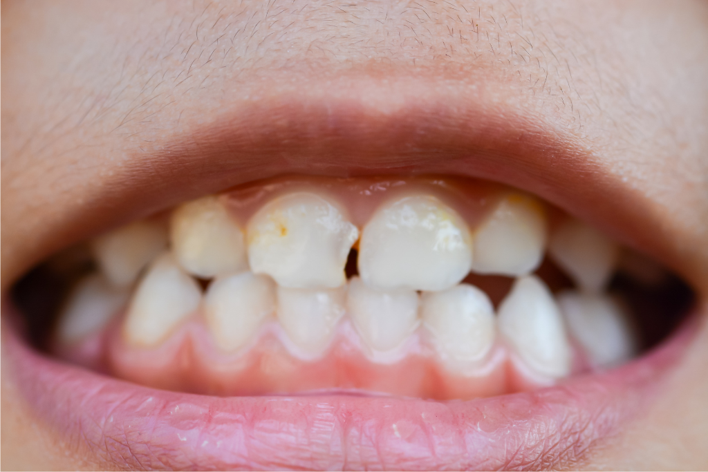 emergency dentistry in East Downtown