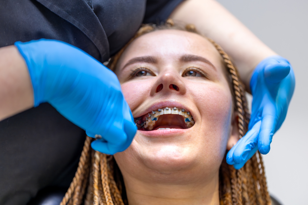 adult braces in East Downtown