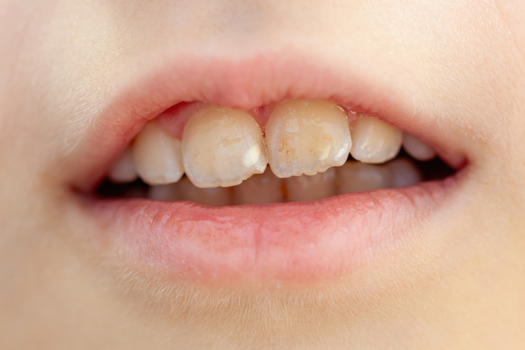 orthodontist in Houston