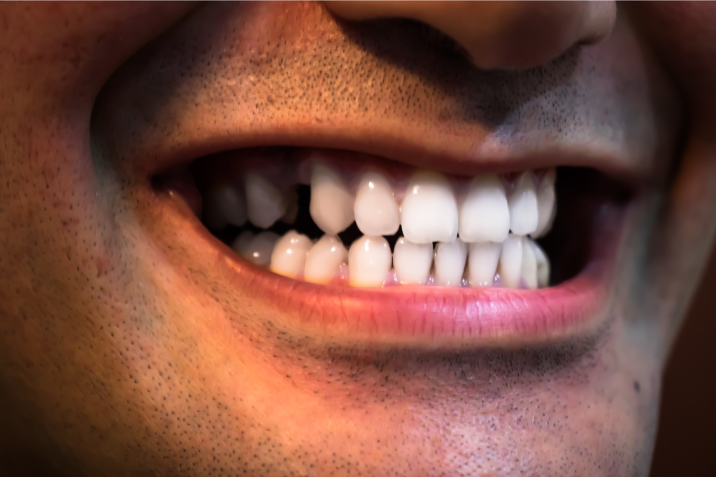 Downtown Houston dentist
